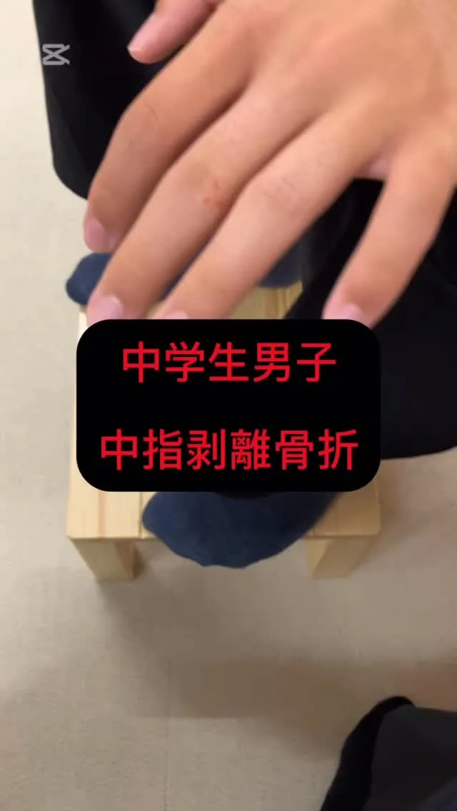 中学生男子　バレーボール部　左手中指剥離骨折